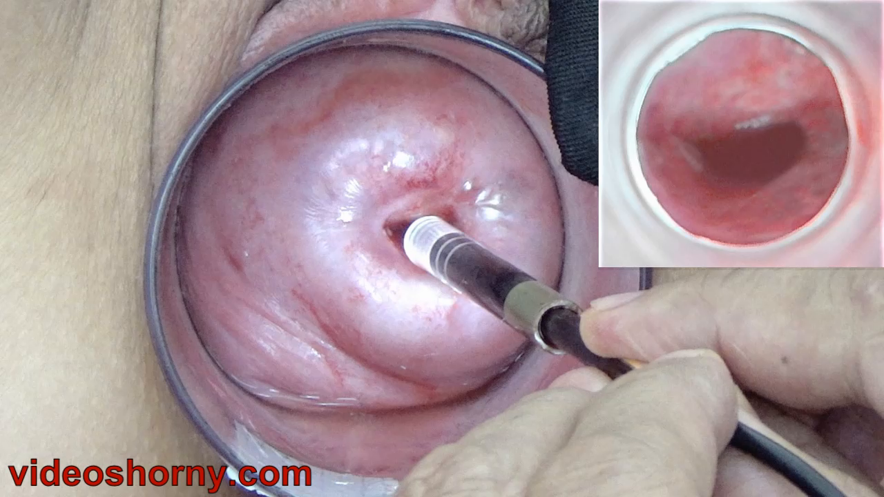 Endoscope Camera inside Cervix Camera into Vagina - Video Cervix in: https://www.videoshorny.com